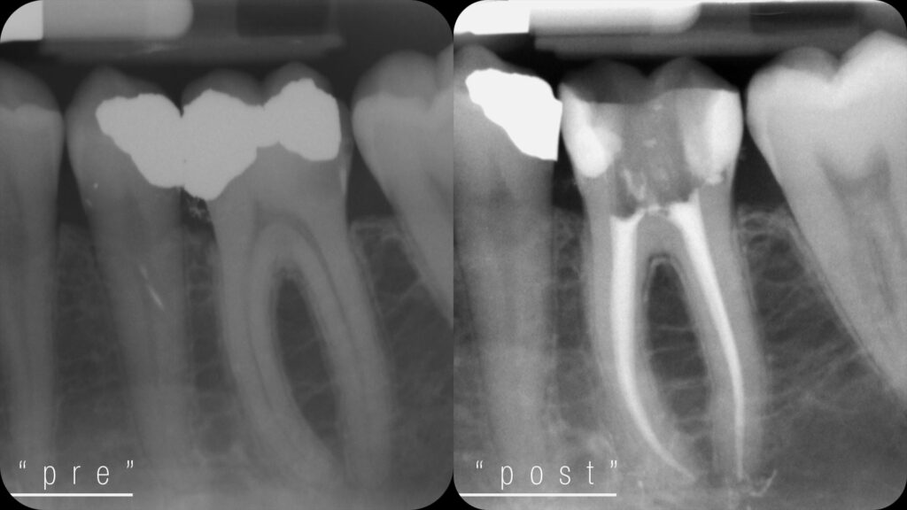 Studio Genzano - Endodonzia
